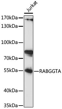 RABGGTA Polyclonal Antibody (E-AB-91623)