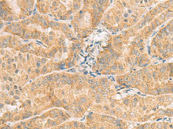 NCOA4 Polyclonal Antibody (E-AB-18736)