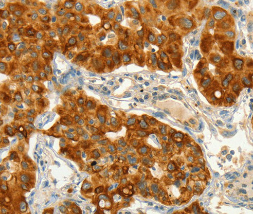 CIB1 Polyclonal Antibody (E-AB-16341)