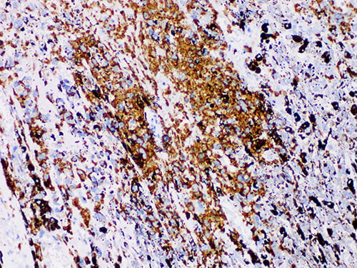 S100P Monoclonal Antibody (ELAB6593-M)