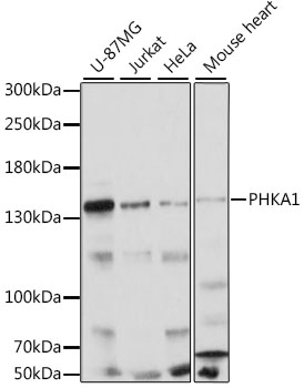 PHKA1 Polyclonal Antibody (E-AB-91251)
