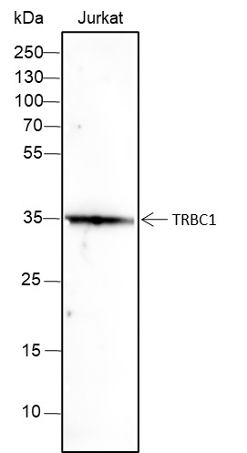 Recombinant TRBC1 Monoclonal Antibody (AN301680L)