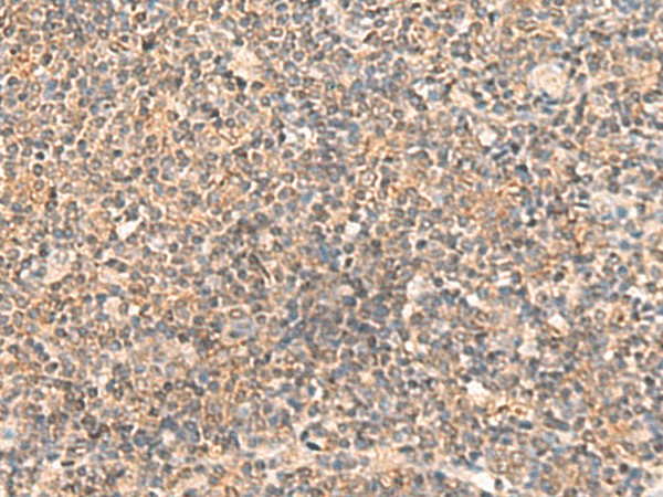 ABCB4 Polyclonal Antibody (E-AB-53413)