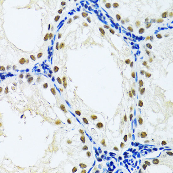 DDB1 Polyclonal Antibody (E-AB-60795)