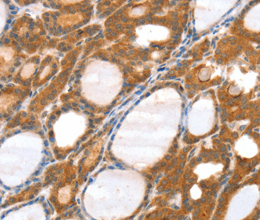 SRGAP3 Polyclonal Antibody (E-AB-11600)