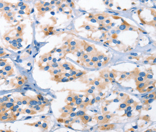 AHR Polyclonal Antibody (E-AB-16242)