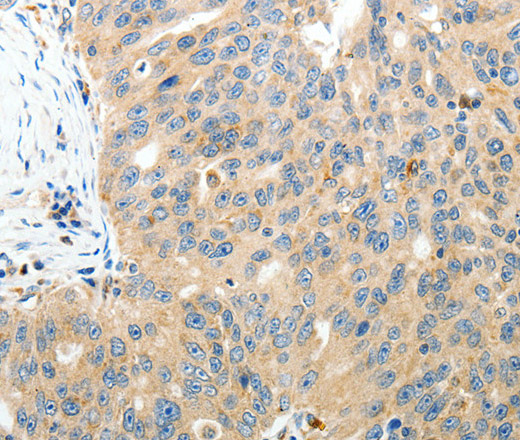 RAMP3 Polyclonal Antibody (E-AB-14309)