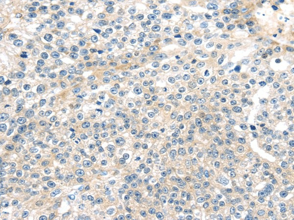TNFAIP8 Polyclonal Antibody (E-AB-17125)