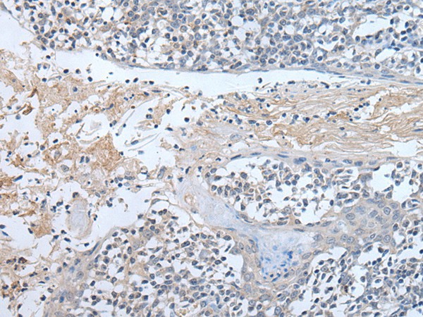 ABR Polyclonal Antibody (E-AB-19532)