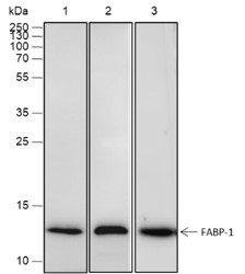 Recombinant FABP1 Monoclonal Antibody (AN301781L)