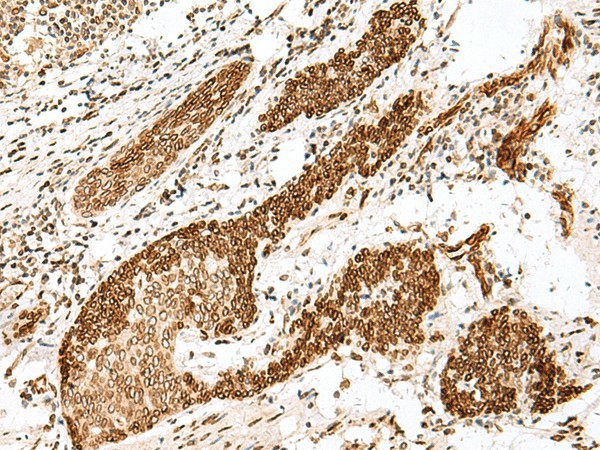 FANCB Polyclonal Antibody (E-AB-17947)