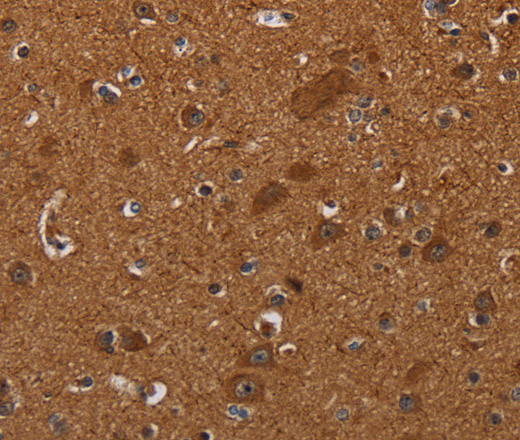 CYBB Polyclonal Antibody (E-AB-13464)