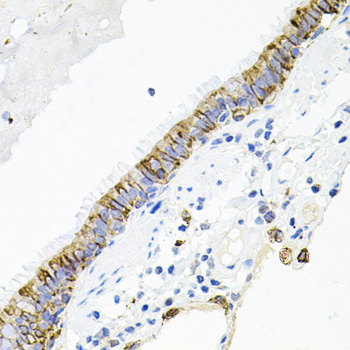ACVR2A Polyclonal Antibody (E-AB-60537)