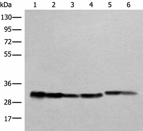 ATP5C1 Polyclonal Antibody (E-AB-52459)
