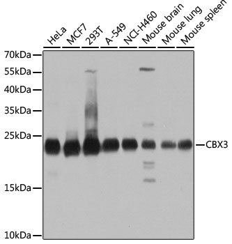(KO Validated) CBX3 Polyclonal Antibody (E-AB-62382)