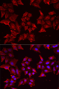 PCBD1 Polyclonal Antibody (E-AB-61927)