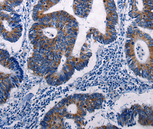 MKP-3 Polyclonal Antibody (E-AB-14069)