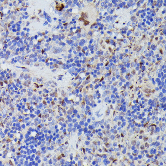 CDC23 Polyclonal Antibody (E-AB-65204)