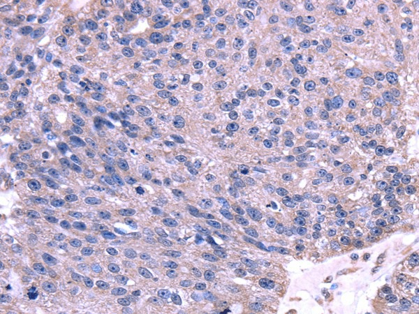 TRIM14 Polyclonal Antibody (E-AB-17090)