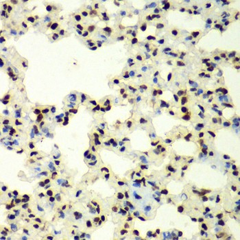 SUMO2 Polyclonal Antibody (E-AB-65231)