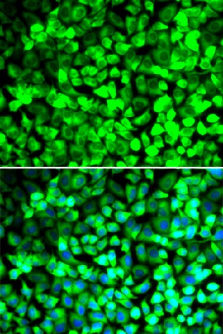 EIF5 Polyclonal Antibody (E-AB-61228)