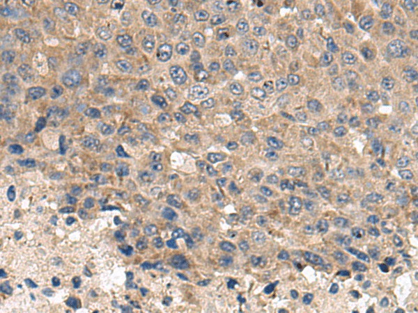 CD59 Polyclonal Antibody (E-AB-53030)