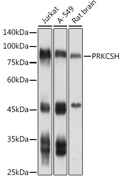 PRKCSH Polyclonal Antibody (E-AB-92564)