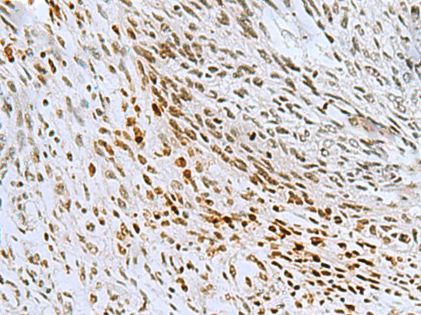 CNOT7 Polyclonal Antibody (E-AB-53112)
