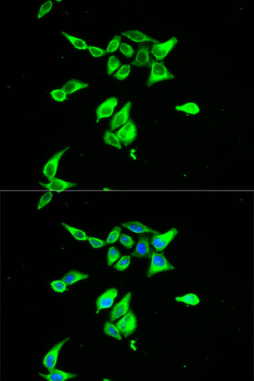 CD55 Polyclonal Antibody (E-AB-60267)