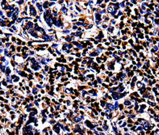 S100A4 Polyclonal Antibody (E-AB-10017)
