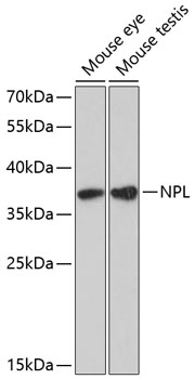 NPL Polyclonal Antibody (E-AB-65615)