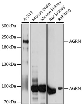 AGRN Polyclonal Antibody (E-AB-91762)