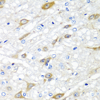 CPA6 Polyclonal Antibody (E-AB-64770)