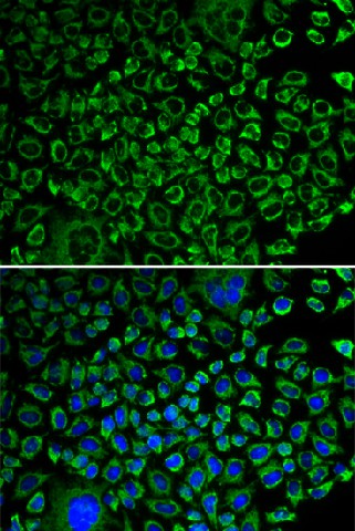 F10 Polyclonal Antibody (E-AB-60311)