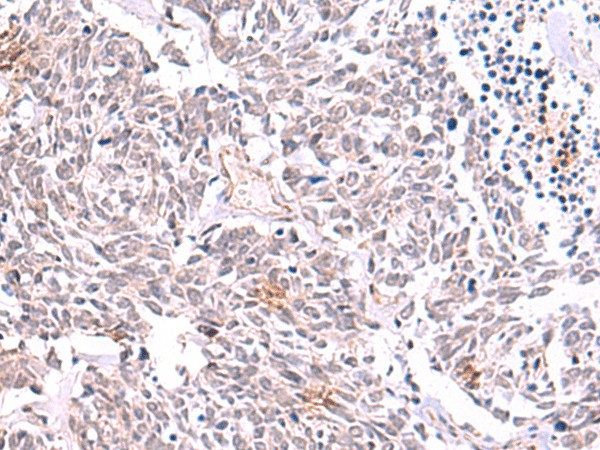 TRMT12 Polyclonal Antibody (E-AB-52959)