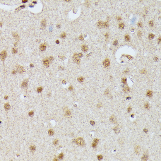 IGHMBP2 Polyclonal Antibody (E-AB-66672)