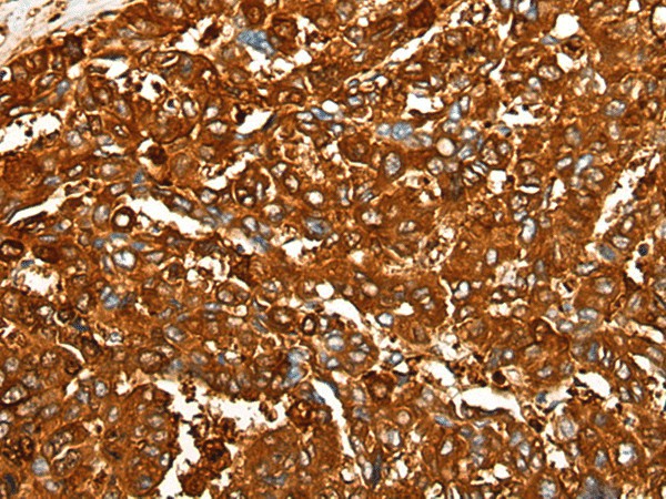 PEAR1 Polyclonal Antibody (E-AB-19565)