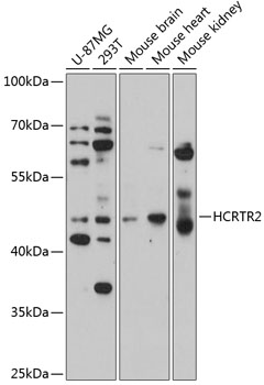 HCRTR2 Polyclonal Antibody (E-AB-92507)