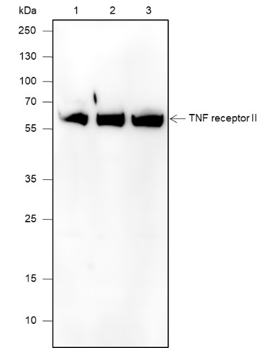 Recombinant TNF receptor II Monoclonal Antibody (AN301888L)