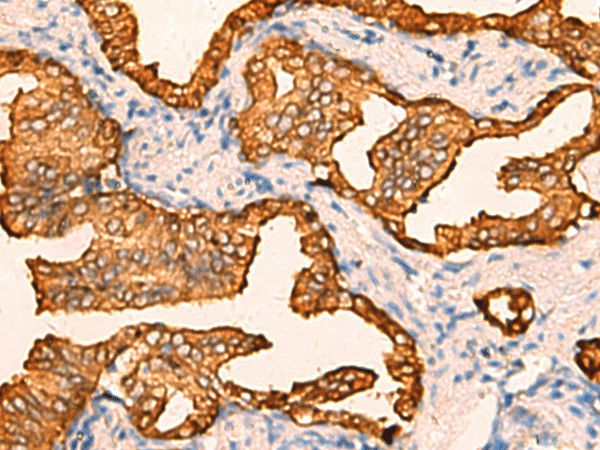 CRYM Polyclonal Antibody (E-AB-53142)