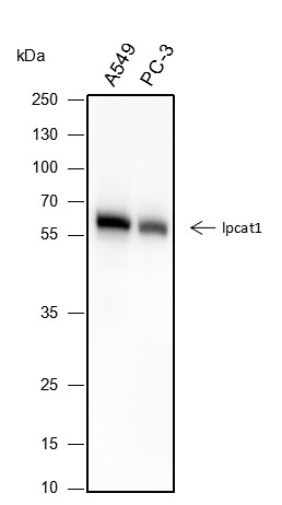 Recombinant LPCAT1 Monoclonal Antibody (AN301588L)