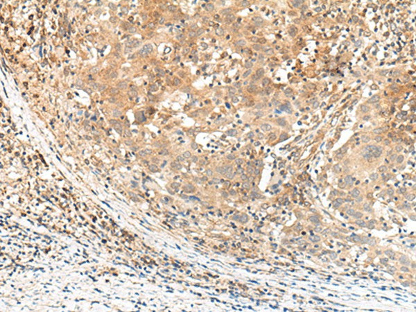 KCNA10 Polyclonal Antibody (E-AB-17934)