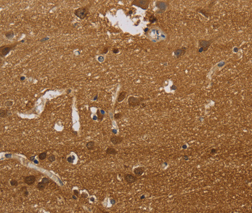 ELAVL2 Polyclonal Antibody (E-AB-16548)