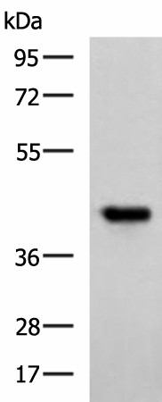 FCRLA Polyclonal Antibody (E-AB-19253)