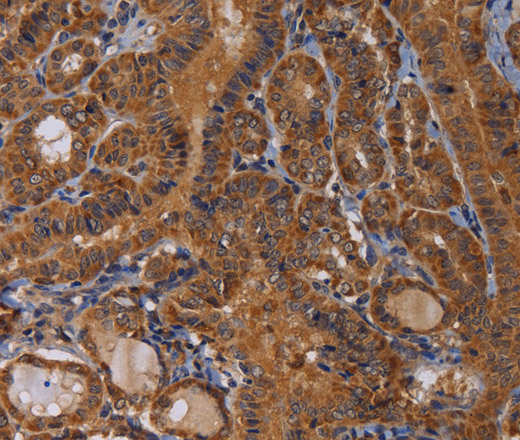 MAGEB10 Polyclonal Antibody (E-AB-11378)