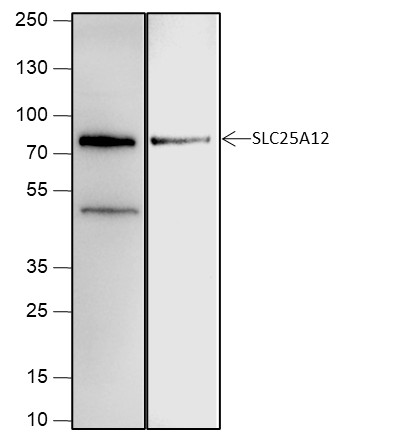 Recombinant SLC25A12 Monoclonal Antibody (AN301939L)