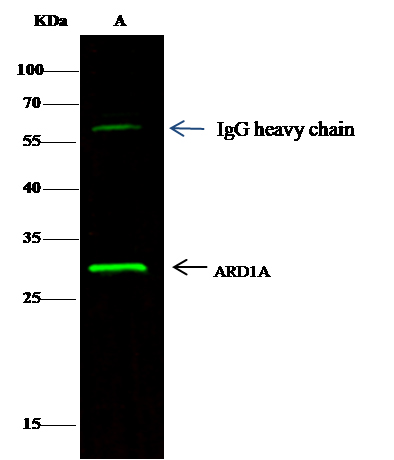ARD1 Monoclonal Antibody (AN200240P)