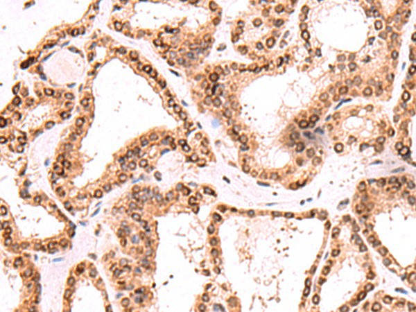 TOR1AIP1 Polyclonal Antibody (E-AB-52965)