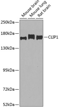CLIP1 Polyclonal Antibody (E-AB-68408)