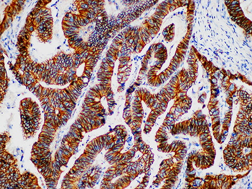Beta-catenin Monoclonal Antibody (ELAB6675-M)